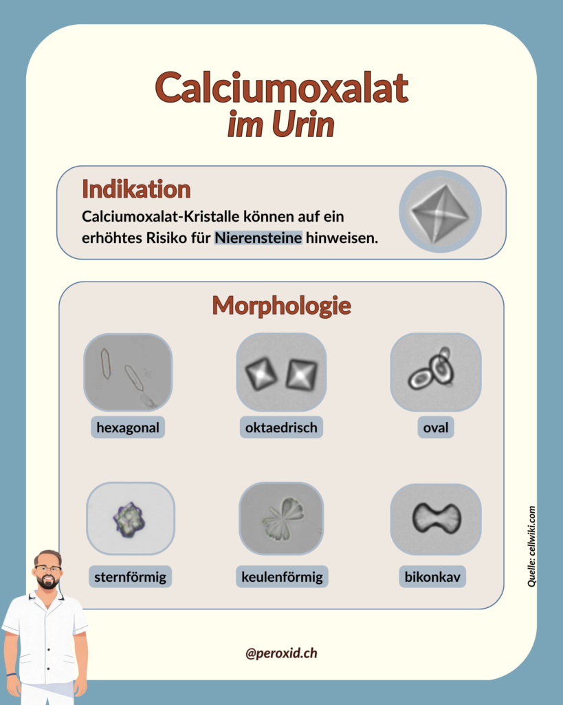 Calciumoxalat Im Urin 1 819x1024