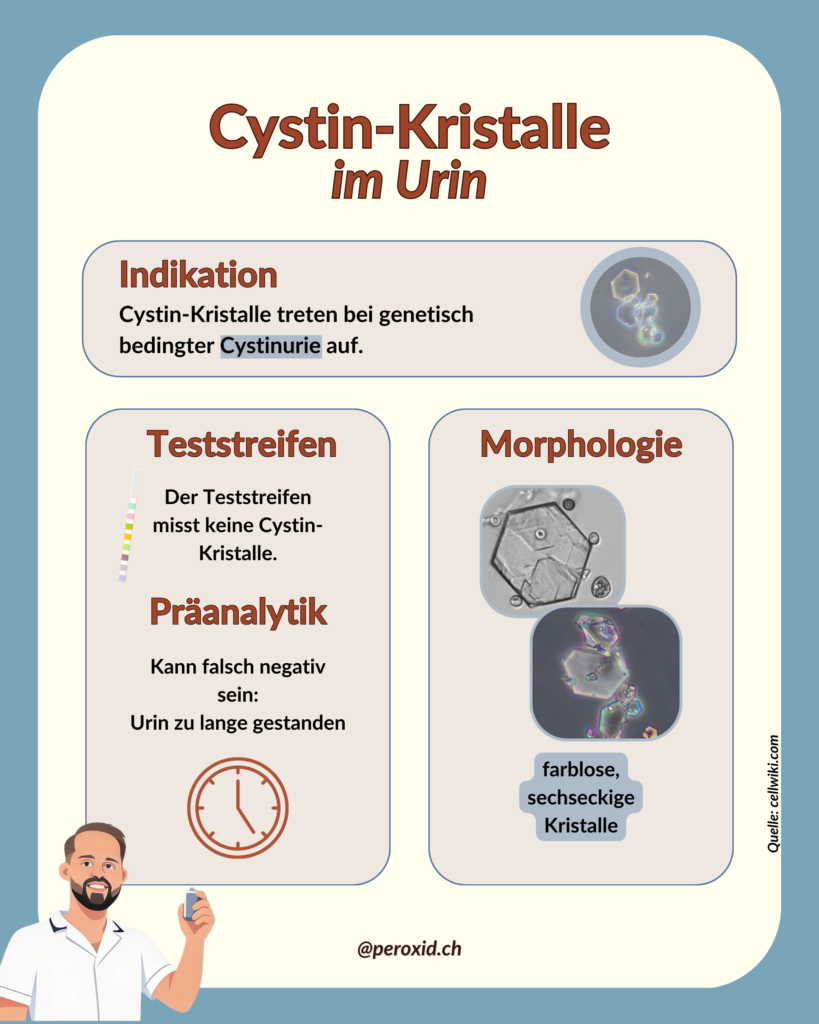Cystin Kristalle Im Urin 2 819x1024