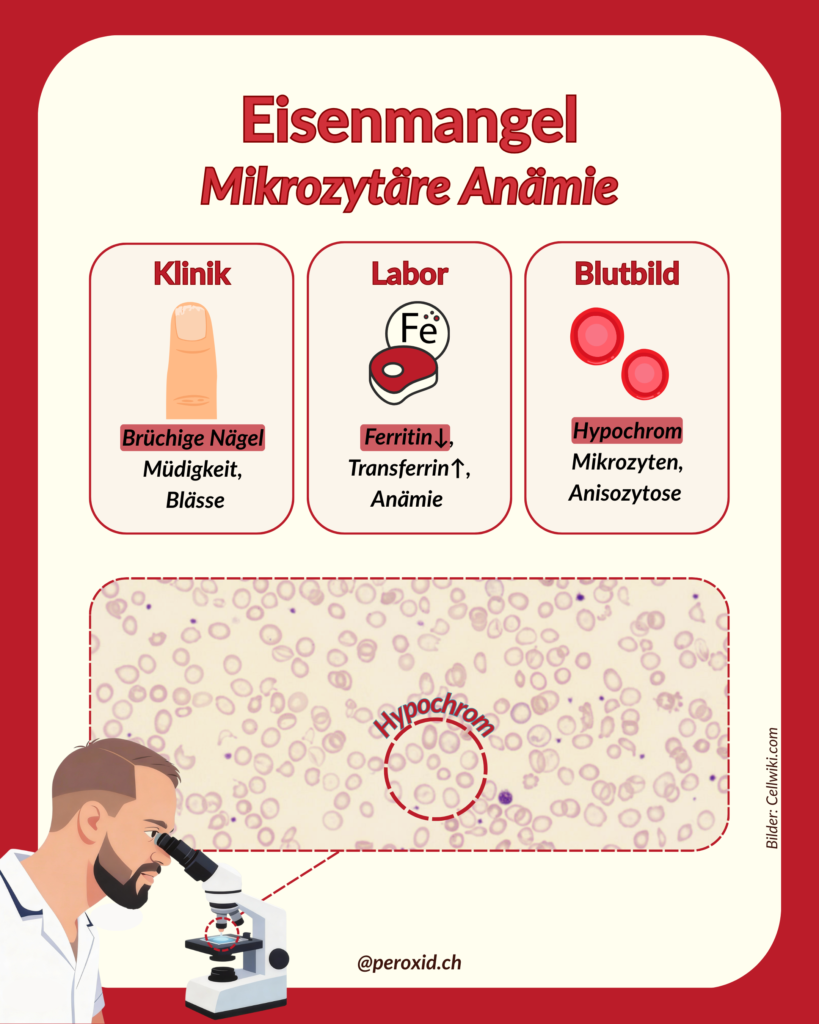 eisenmangel