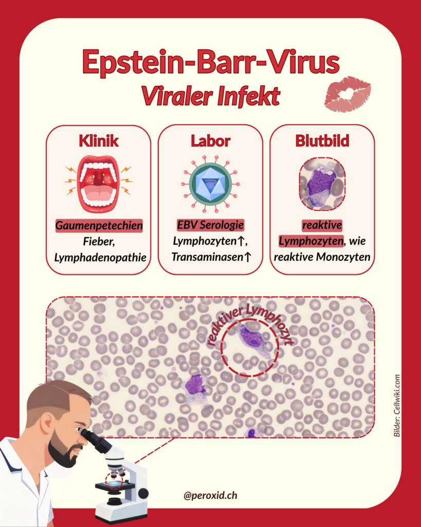 Epstein Barr Virus 819x1024