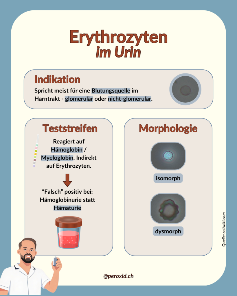 erythrozyten im urin