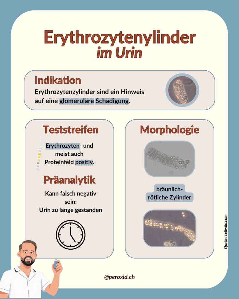 erythrozytenzylinder im urin