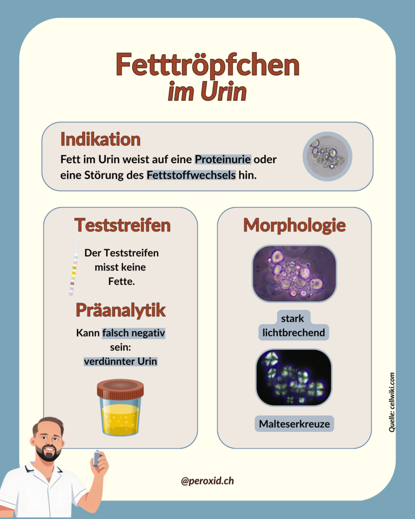 Fett Im Urin 1 819x1024