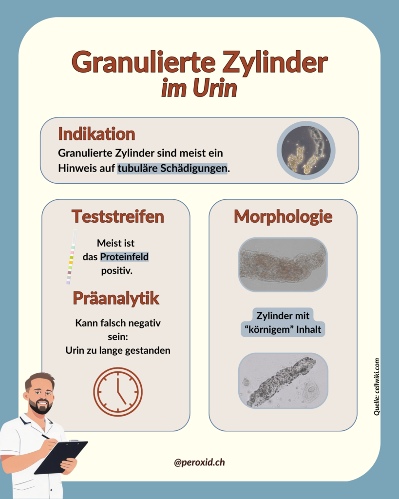 granulierte zylinder im urin