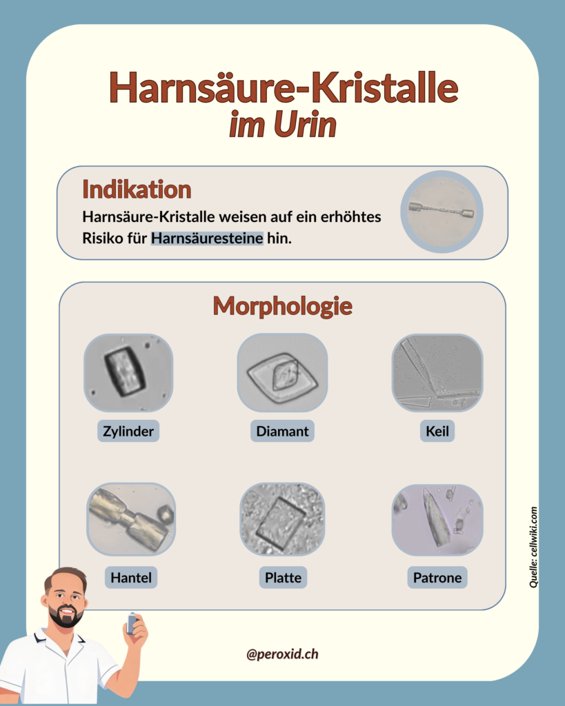 Harnsaeure Kristalle Im Urin 1 819x1024