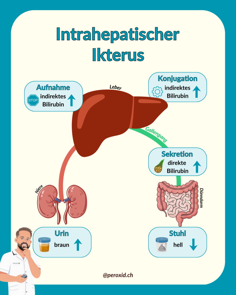intrahepatischer ikterus