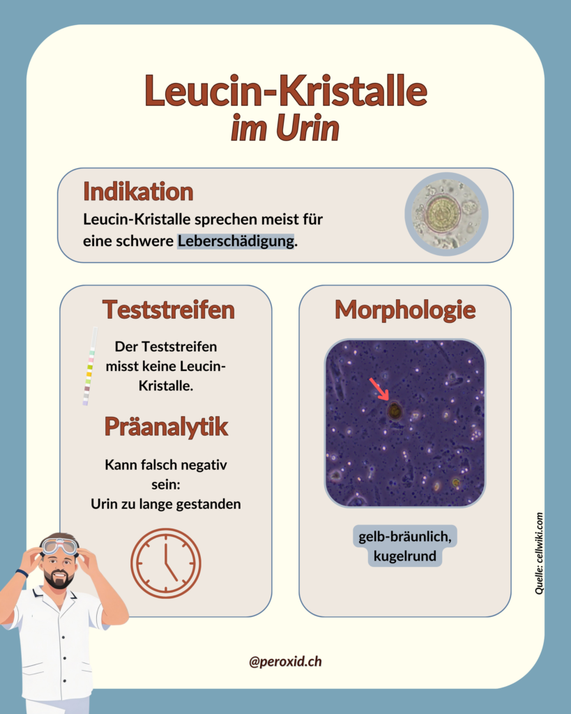 leucin kristalle im urin