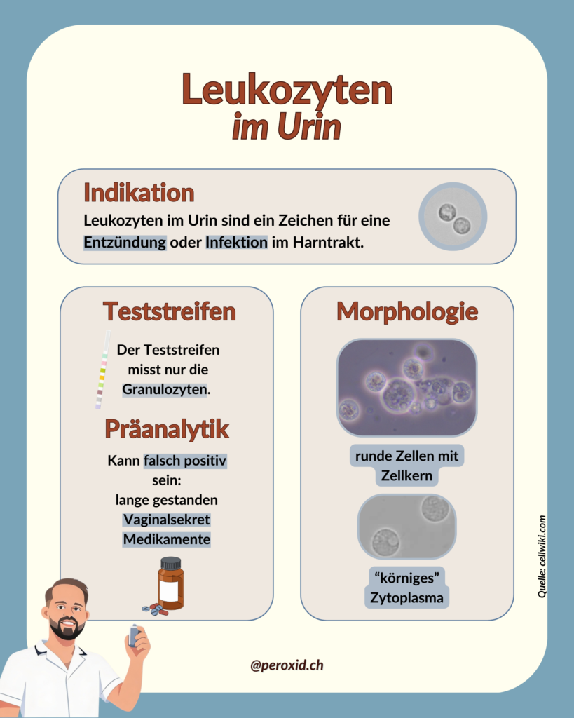 Leukozyten Im Urin 1 819x1024