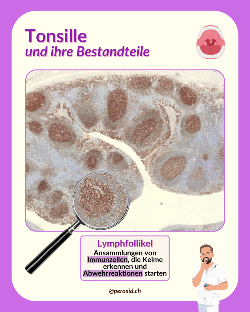 Tonsille Und Lymphfollikel 819x1024