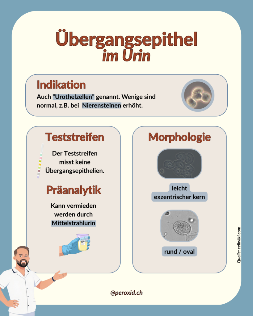 Uebergangsepithel Im Urin 1 819x1024
