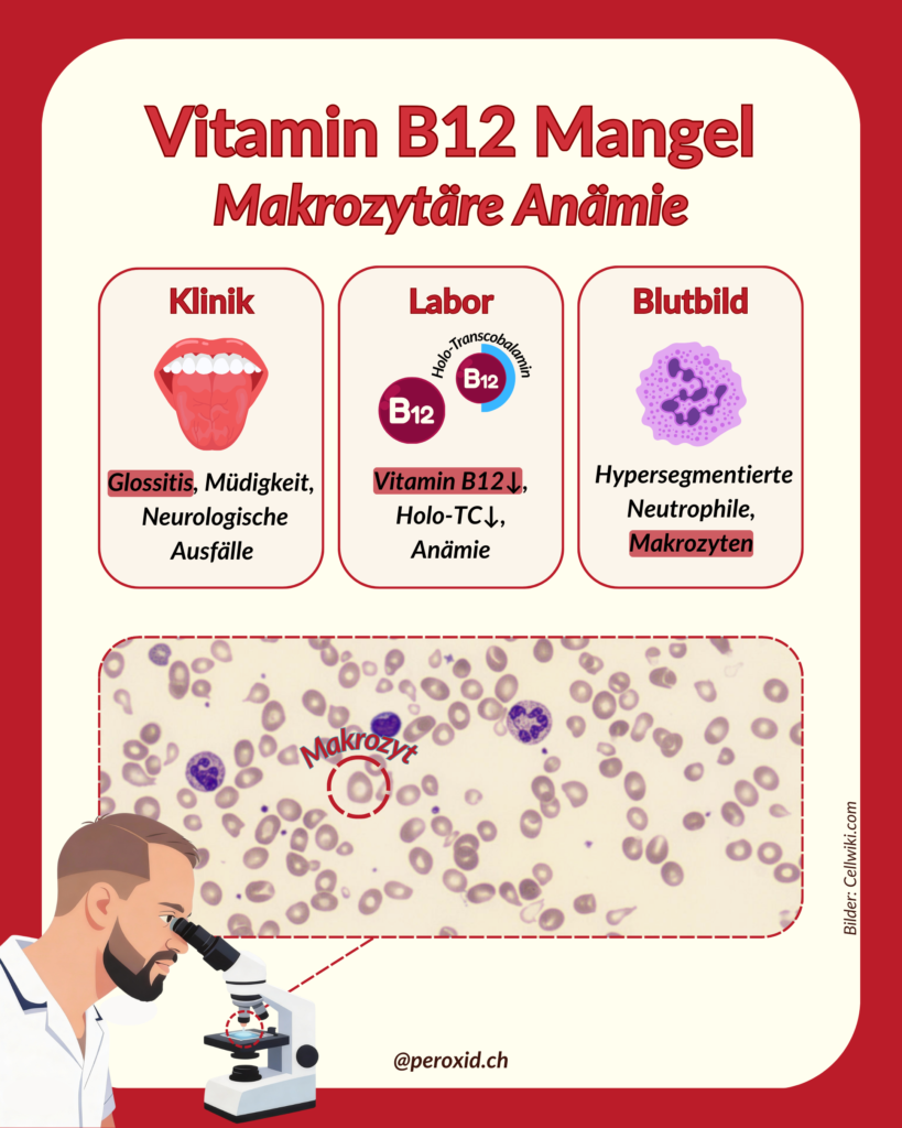 vitamin b12 mangel