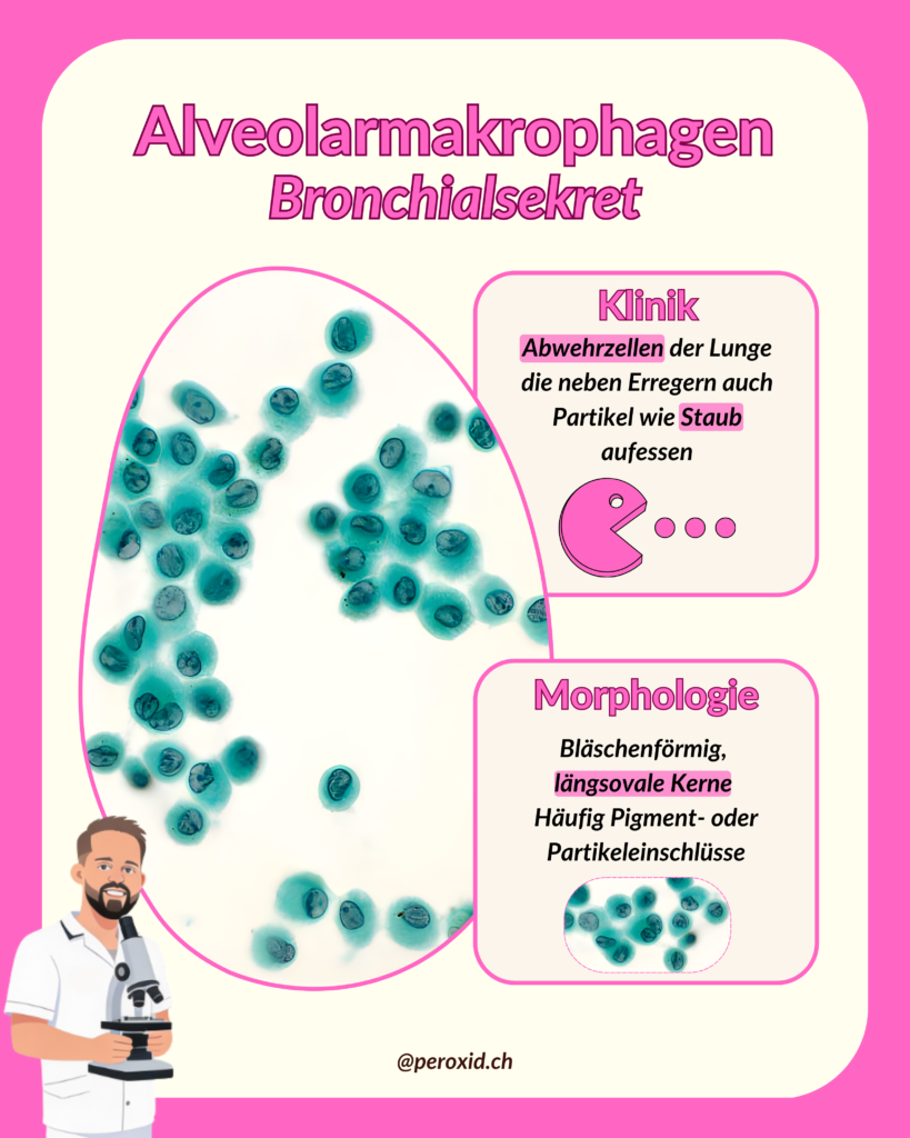 alveolarmakrophagen