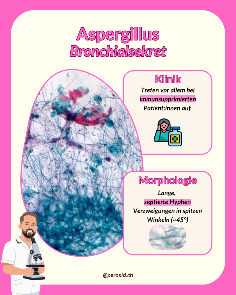Aspergillus Lunge 819x1024