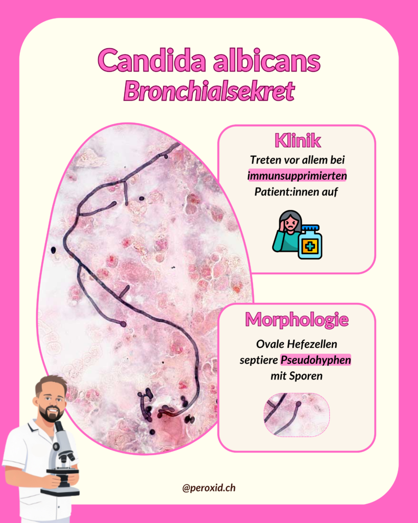 candida albicans lunge