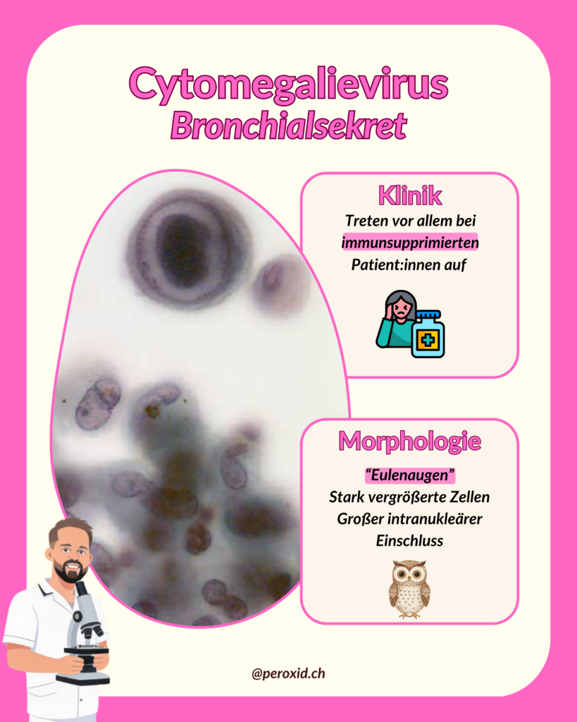 Cytomegalievirus Lunge 819x1024