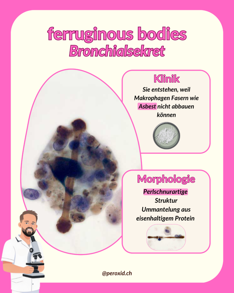 Ferruginous Bodies 819x1024