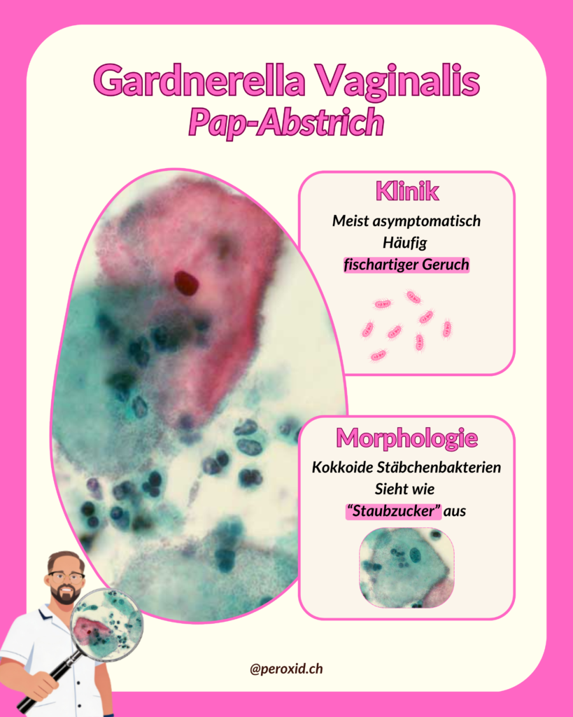 gardnerella vaginalis