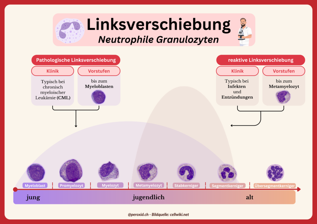 linksverschiebung