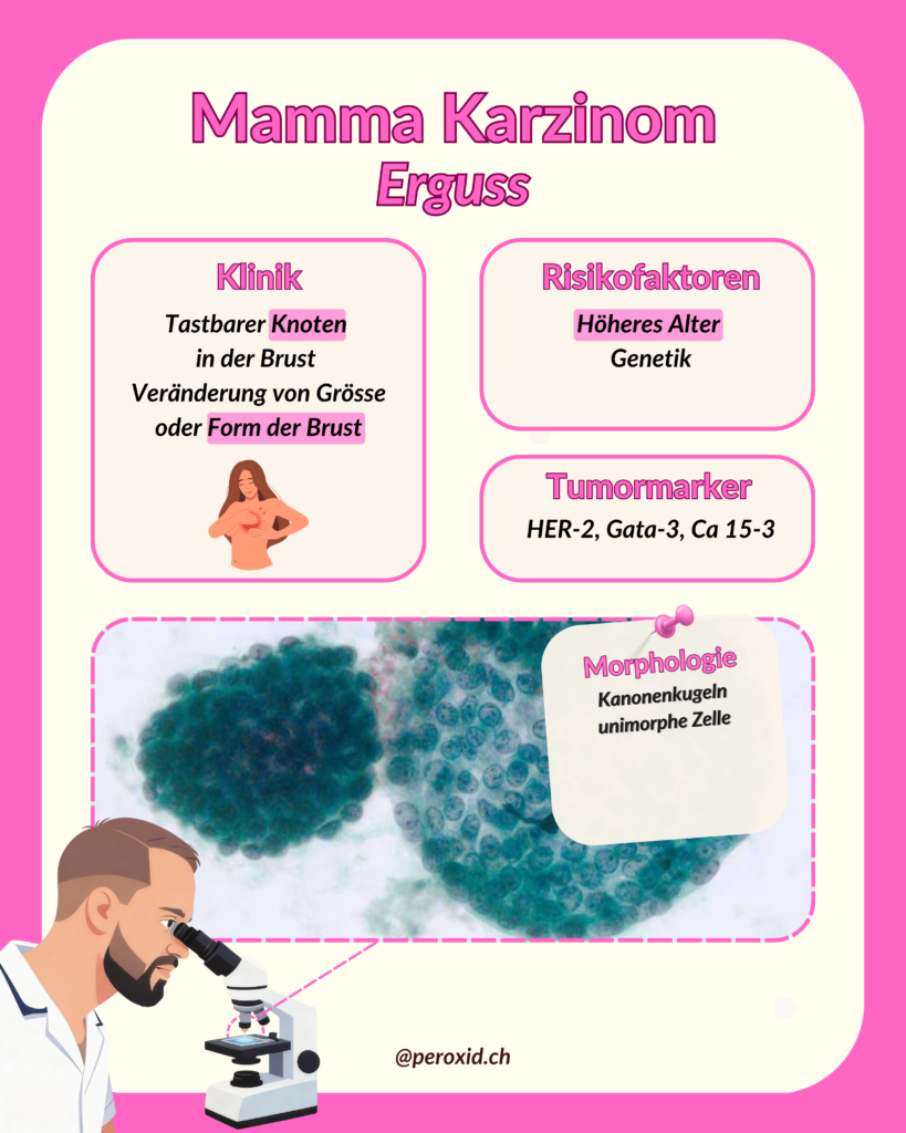 Mamma Karzinom 819x1024