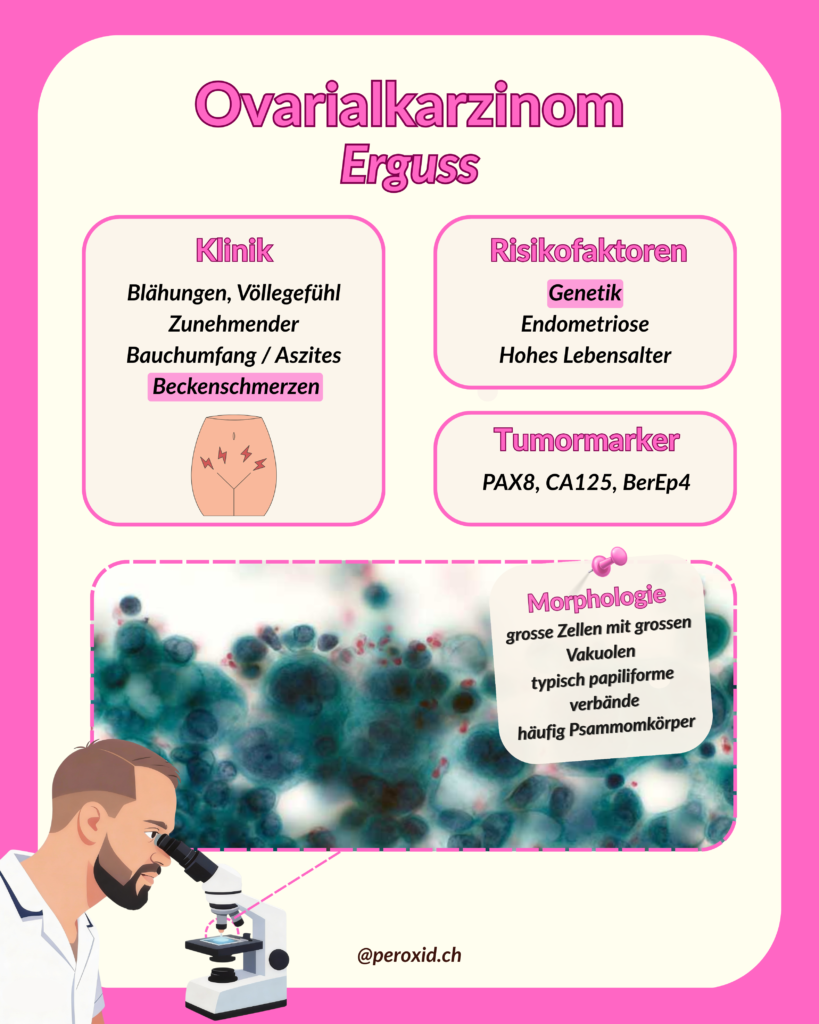 ovarialkarzinom