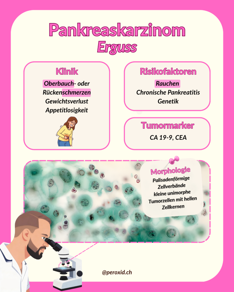 pankreaskarzinom