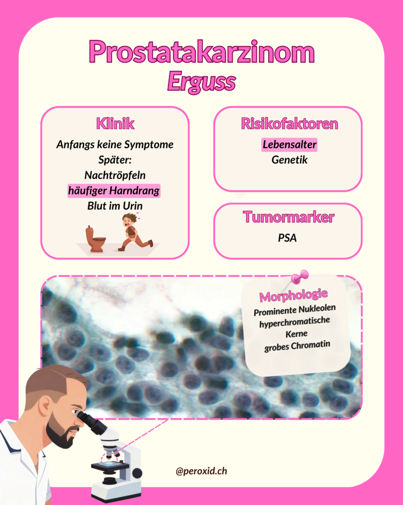prostatakarzinom