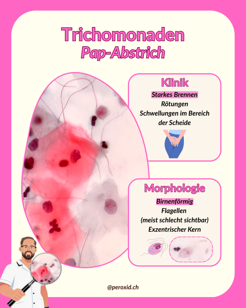 Trichomonaden 819x1024