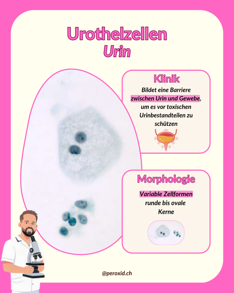urothelzellen